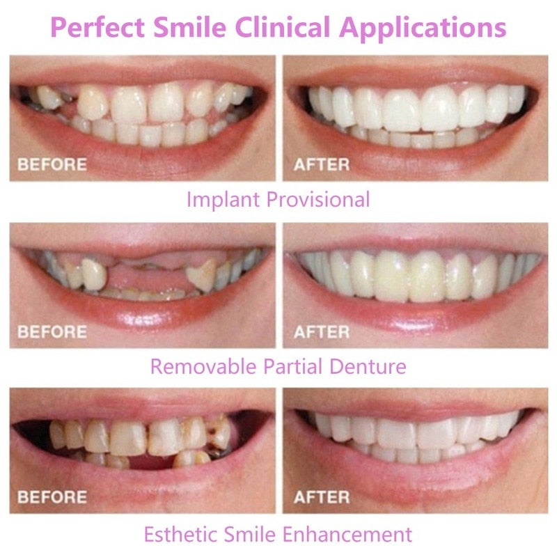 Täydellinen hymy – säädettävät napsautettavat hammasproteesit (2023-versio)