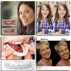 Perfect Smile - Adjustable Snap-On Dentures (2023 Edition)